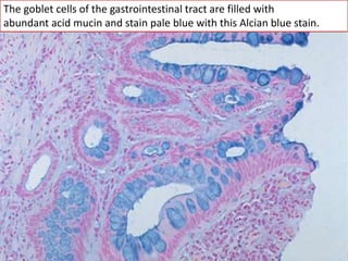 The goblet cells of the gastrointestinal tract are filled with
abundant acid mucin and stain pale blue with this Alcian blue stain.
 