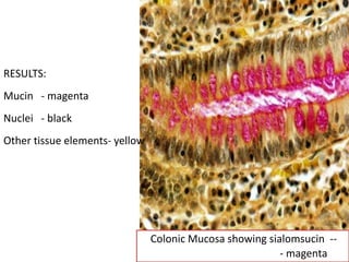 Colonic Mucosa showing sialomsucin --
- magenta
RESULTS:
Mucin - magenta
Nuclei - black
Other tissue elements- yellow
 