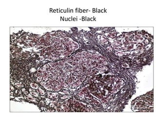 Reticulin fiber- Black
Nuclei -Black
 