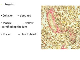 • Results:
• Collagen – deep red
• Muscle, – yellow
cornified epithelium
• Nuclei – blue to black
 