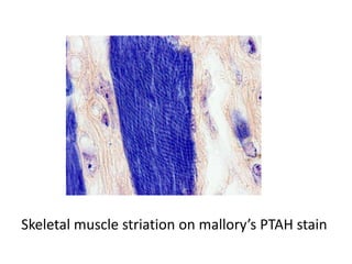 Skeletal muscle striation on mallory’s PTAH stain
 