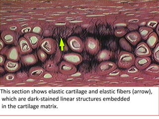 This section shows elastic cartilage and elastic fibers (arrow),
which are dark-stained linear structures embedded
in the cartilage matrix.
 