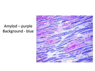 Amylod – purple
Background - blue
 