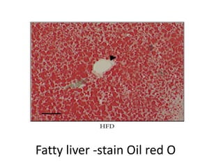 Fatty liver -stain Oil red O
 