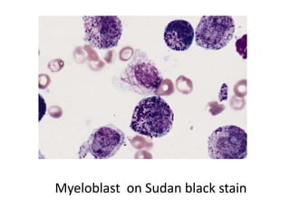 Myeloblast on Sudan black stain
 