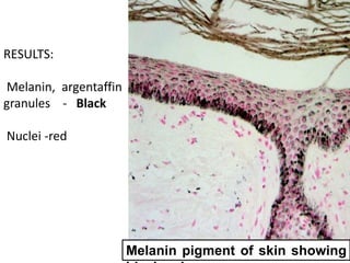 Melanin pigment of skin showing
RESULTS:
Melanin, argentaffin
granules - Black
Nuclei -red
 