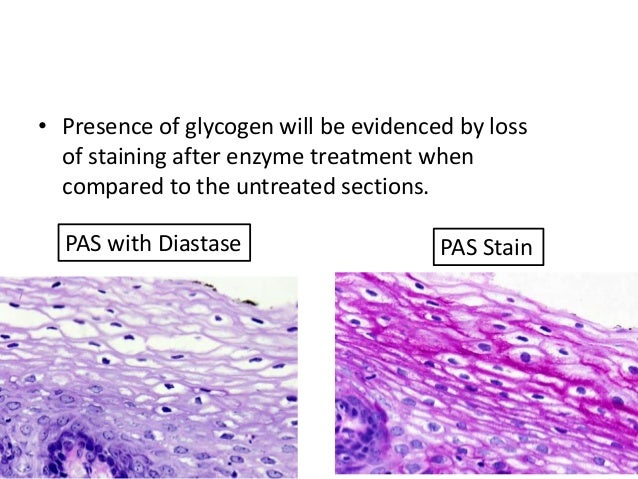 Image result for pas vs pasd stain