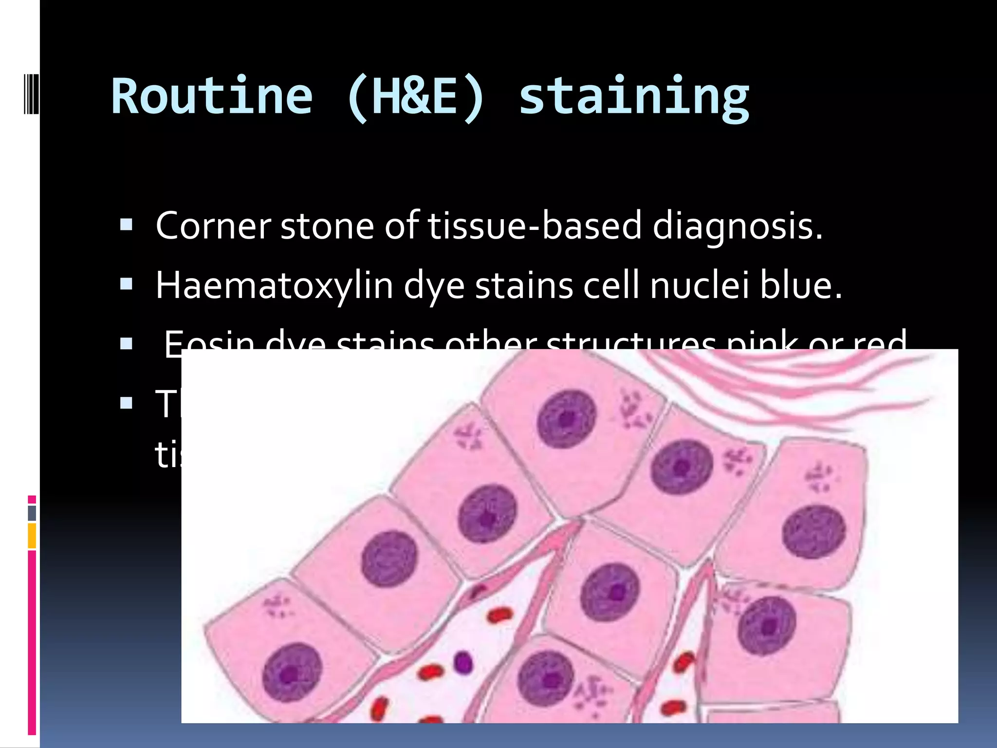 Routine (H&E) staining
 Corner stone of tissue-based diagnosis.
 Haematoxylin dye stains cell nuclei blue.
 Eosin dye stains other structures pink or red.
 This technique provides exceptional detail of
tissue structure and the makeup of the cells.
 