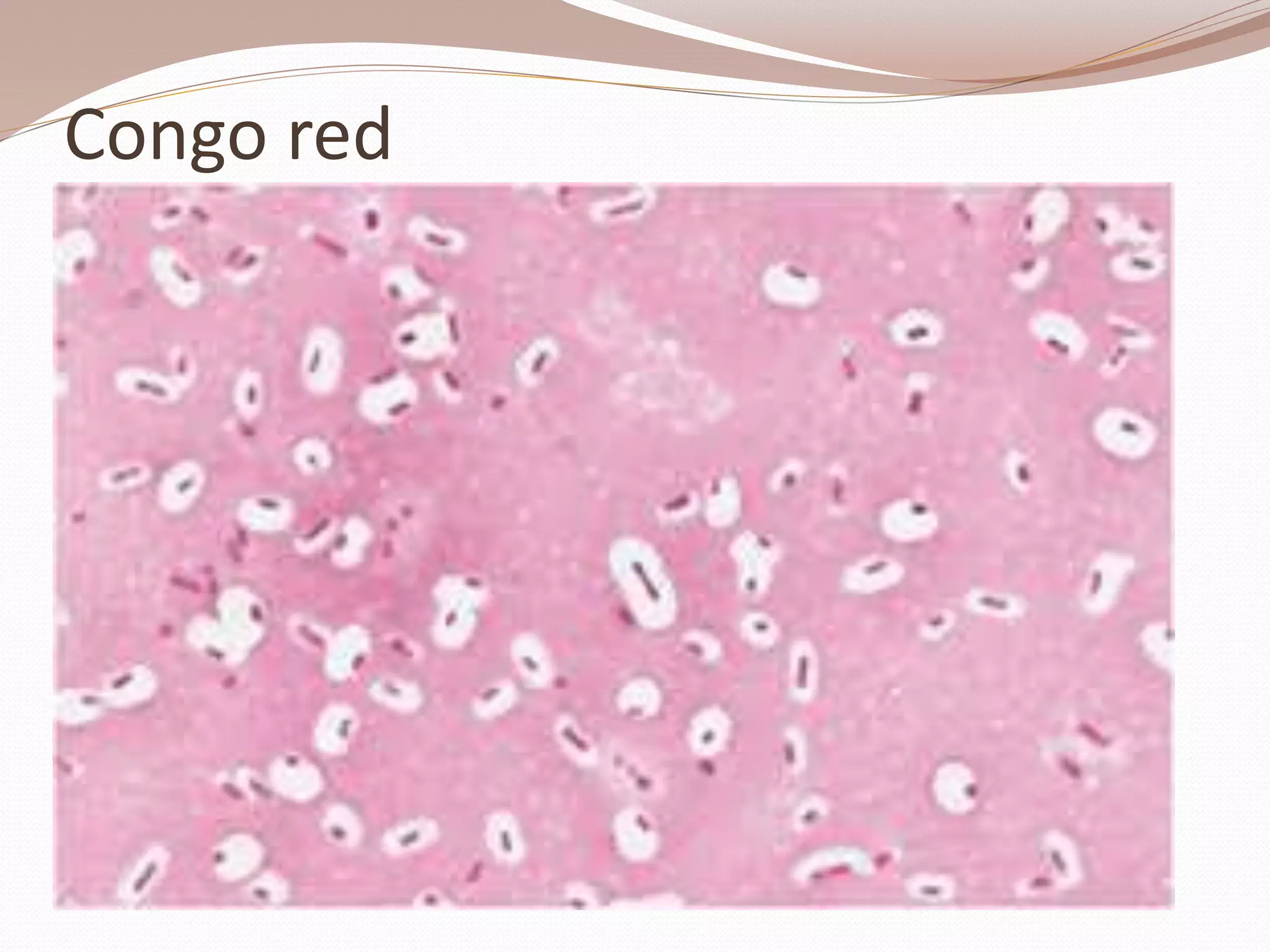 Congo red
 