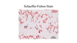 Schaeffer-Fulton Stain
 