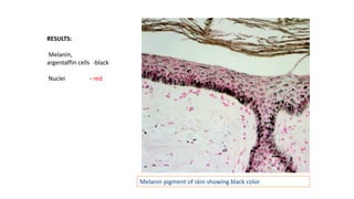 Melanin pigment of skin showing black color
RESULTS:
Melanin,
argentaffin cells -black
Nuclei - red
 