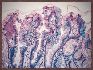 Special stains by sowmya