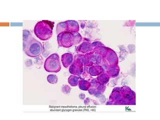Special Stains In Cytology