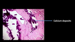 Special stains in dermato pathology - final copy | PPTX