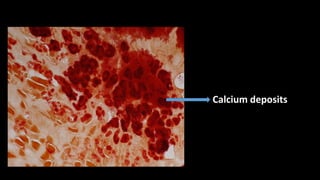 Special stains in dermato pathology - final copy | PPTX