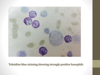 Special stains in hematology | PPTX