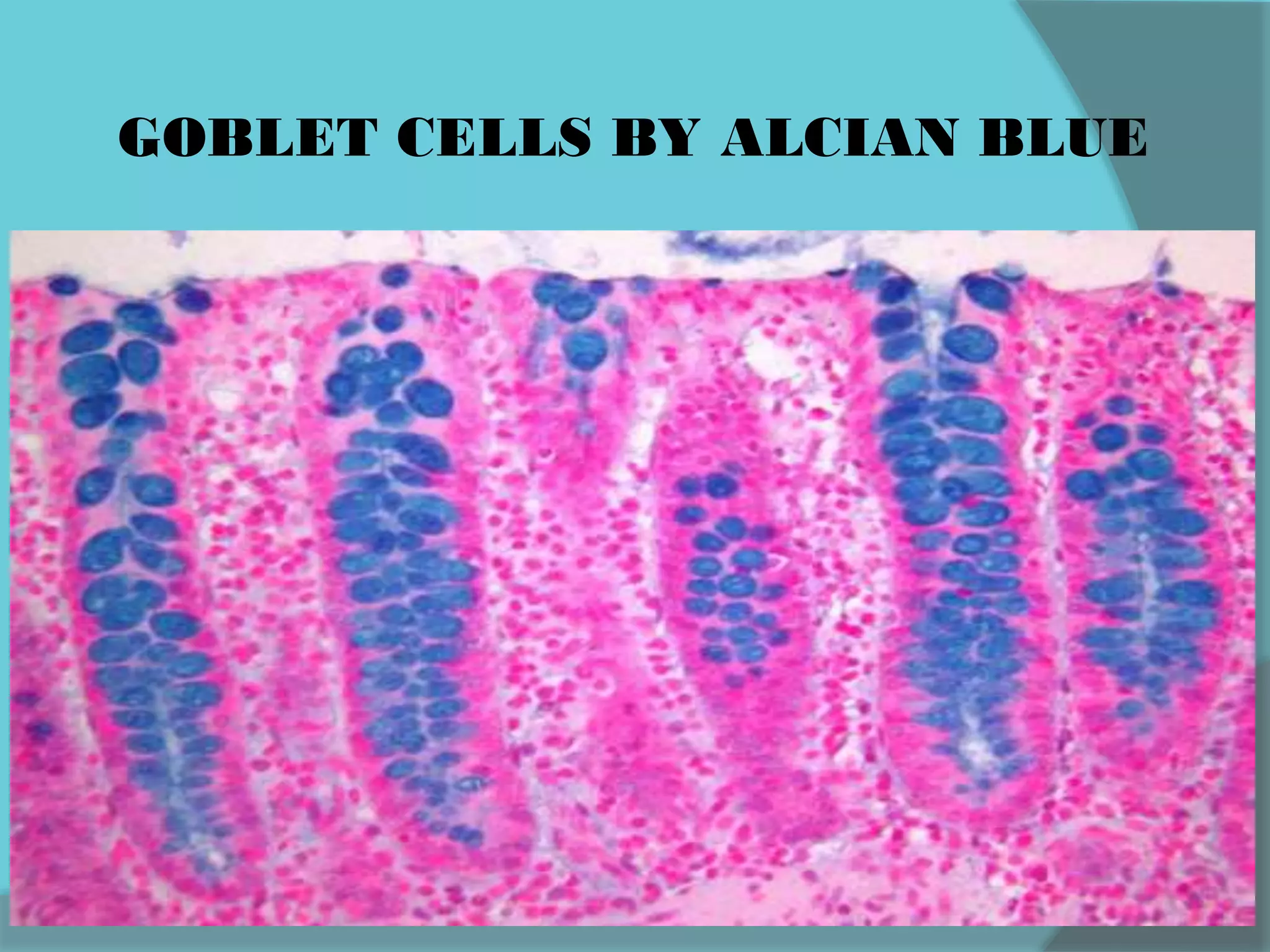 GOBLET CELLS BY ALCIAN BLUE
 