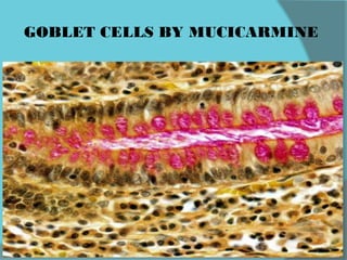 GOBLET CELLS BY MUCICARMINE
 