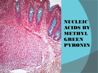 NUCLEIC
ACIDS BY
METHYL
GREEN
PYRONIN
 