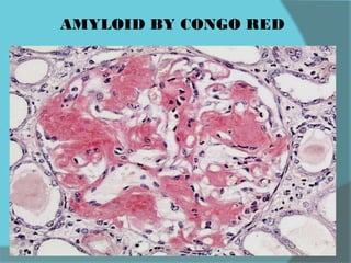 AMYLOID BY CONGO RED
 