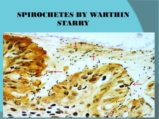 SPIROCHETES BY WARTHIN
STARRY
 