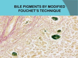 BILE PIGMENTS BY MODIFIED
FOUCHET’S TECHNIQUE
 