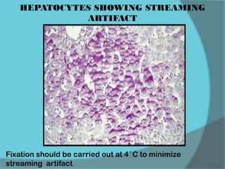 HEPATOCYTES SHOWING STREAMING
ARTIFACT
Fixation should be carried out at 4 ̊ C to minimize
streaming artifact
 