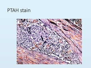 special stains in histopathology techiqu | PPTX