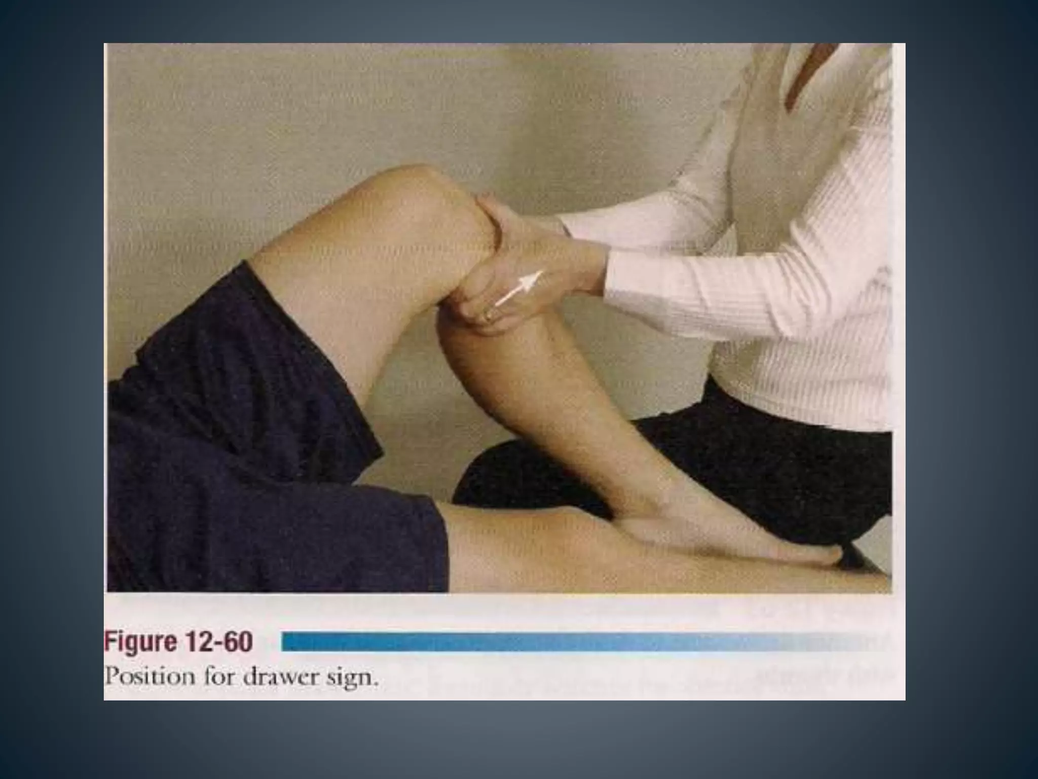 Knee Testing Special Tests - Knee | PPTX