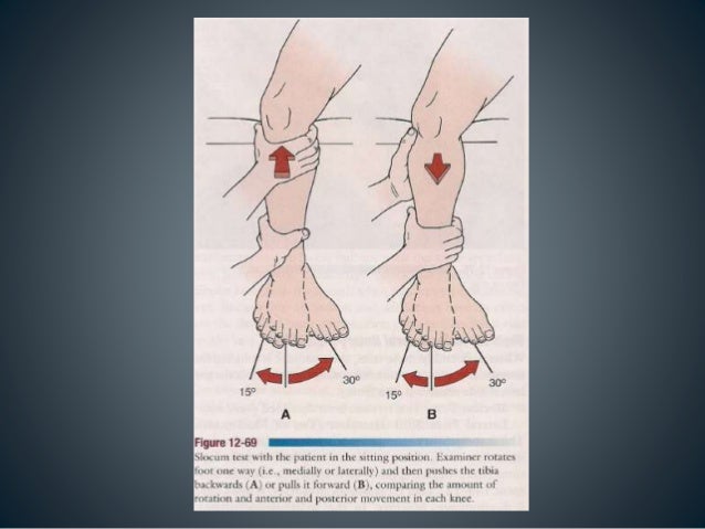 Special Tests Knee