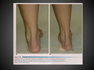 Special Tests for Lower Leg, Ankle, and Foot | PPTX