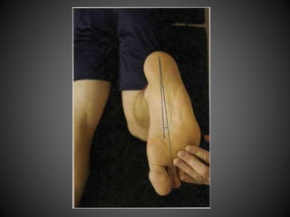 Special Tests for Lower Leg, Ankle, and Foot | PPTX