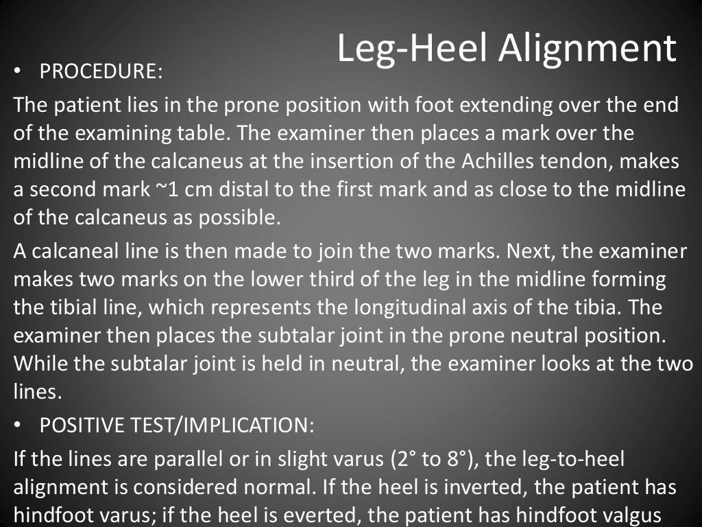 Special Tests for Lower Leg, Ankle, and Foot