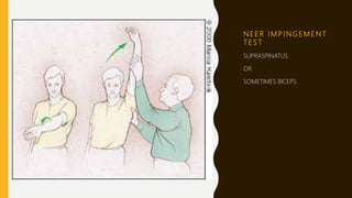 N E E R I M P I N G E M E N T
T E S T
SUPRASPINATUS
OR
SOMETIMES BICEPS
 