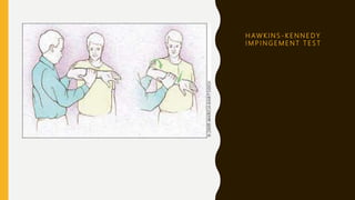 H AW K I N S - K E N N E D Y
I M P I N G E M E N T T E S T
 