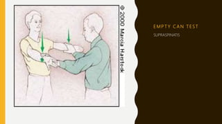 E M P T Y C A N T E S T
SUPRASPINATIS
 