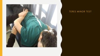 T E R E S M I N O R T E S T
 