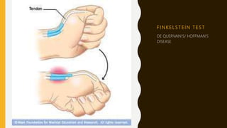 F I N K E L S T E I N T E S T
DE QUERVAIN’S/ HOFFMAN’S
DISEASE
 