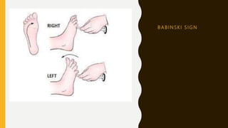 B A B I N S K I S I G N
 