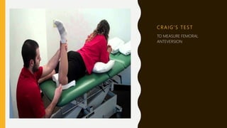C R A I G ’ S T E S T
TO MEASURE FEMORAL
ANTEVERSION
 