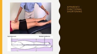 A P PA R E N T /
F U N C T I O N A L
S H O R T E N I N G
 