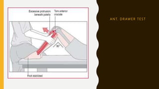 A N T. D R AW E R T E S T
 