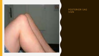 P O S T E R I O R S AG
S I G N
 