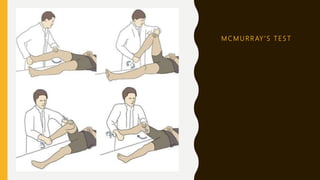M C M U R R AY ’ S T E S T
 