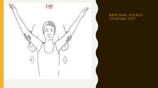 B R AC H I A L P L E X U S
T E N S I O N T E S T
 