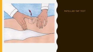 PAT E L L A R TA P T E S T
 