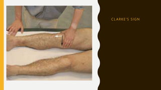 C L A R K E ’ S S I G N
 