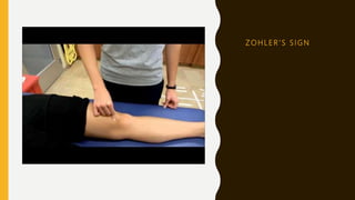 Z O H L E R ’ S S I G N
 