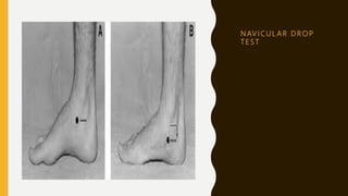 N AV I C U L A R D R O P
T E S T
 