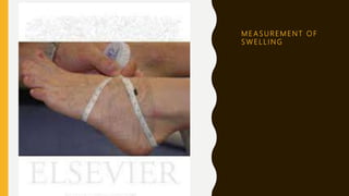 M E A S U R E M E N T O F
S W E L L I N G
 